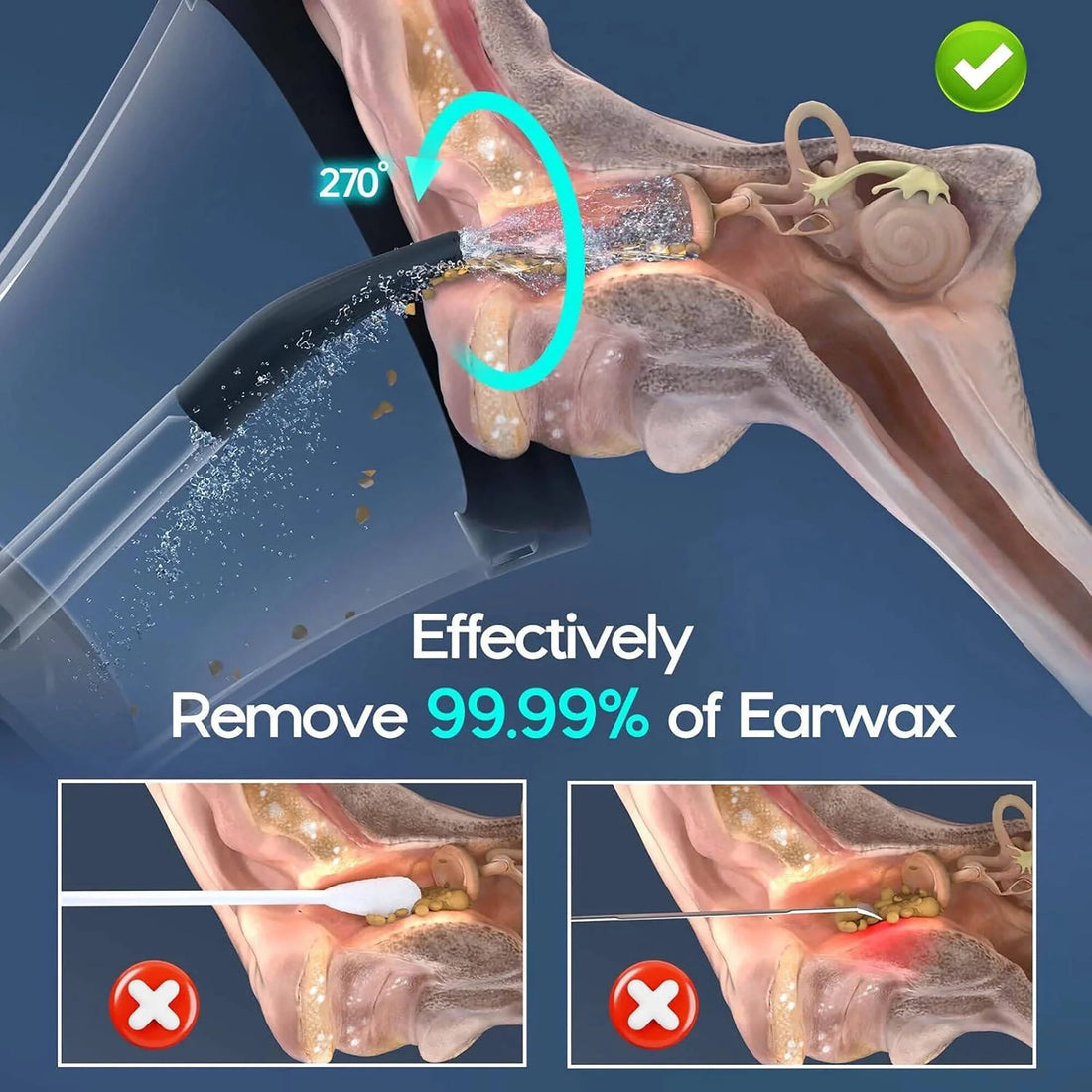 Morfone Electric Ear Cleaning Kit – Safe, Smart &amp; Effective Earwax Removal with One-Piece Dual Tank, Water Temperature Sensor, 4 Cleaning Modes &amp; IPX6 Waterproof