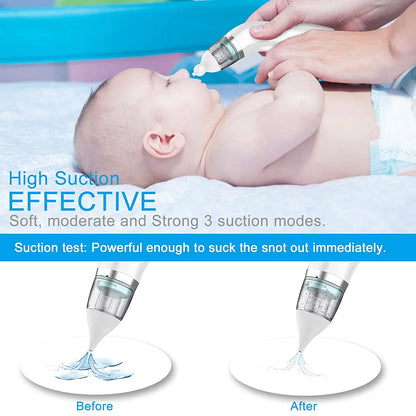 Electric Baby Nasal Aspirator with Music – Automatic Infant Nose Cleaner with 4 Replacement Nozzles, 3 Adjustable Suction Levels &amp; USB Rechargeable