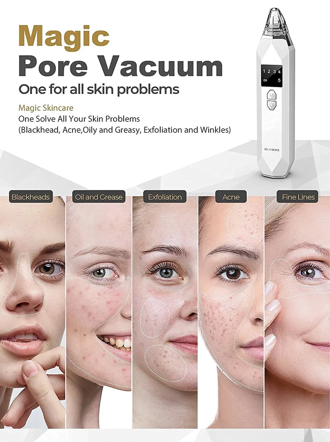 Electric Blackhead Remover Facial Vacuum Cleaner – Rechargeable Acne &amp; Pore Cleaning Tool for Deep Facial Care – Black