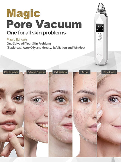 Electric Blackhead Remover Facial Vacuum Cleaner – Rechargeable Acne &amp; Pore Cleaning Tool for Deep Facial Care – Black