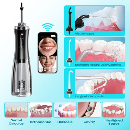 Visual Cordless Water Flosser with 1080P Camera – Next-Level Teeth Cleaning