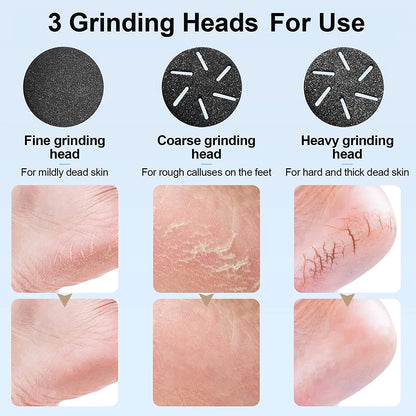 Electric Foot Callus Remover with Vacuum Cleaner – Rechargeable Foot File Dead Skin Remover with 2-Speed Settings, 3 Grinding Heads, LCD Display – Professional Black Foot Care Kit