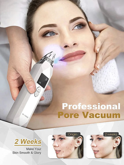 Electric Blackhead Remover Facial Vacuum Cleaner – Rechargeable Acne &amp; Pore Cleaning Tool for Deep Facial Care – Black